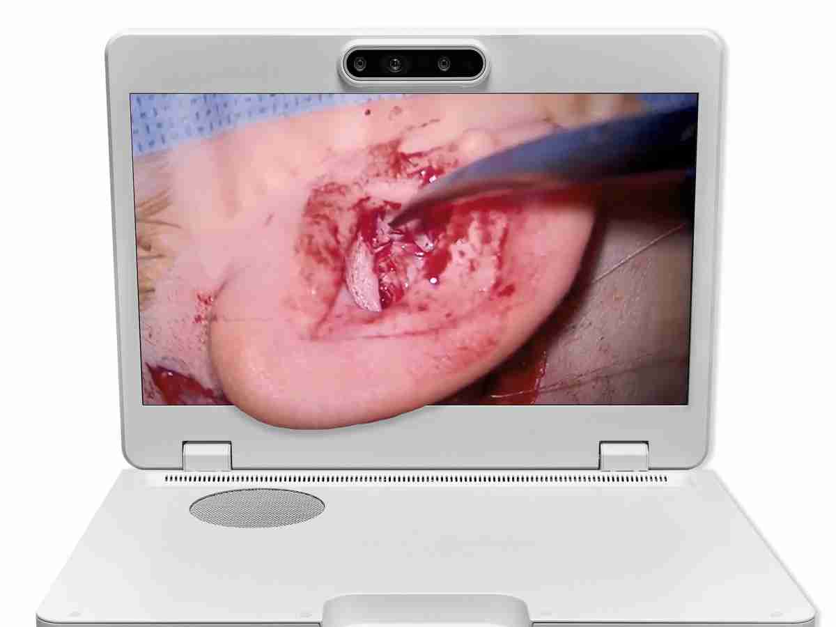 达擎之＂Heads-up 3D显微手术显示系统＂，，整合4K裸眼3D显示及眼球追踪系统，，，具备快速追踪人眼移动位置功能，，，减轻医师长时间维持固定姿势的负担，，，让医师能有更宽广清晰的3D立体视野及更舒适的姿势来执行手术。。。。